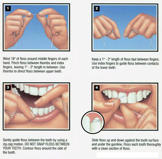 PDAS “C” Flossing Technique